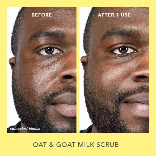 Summer Glow Skincare Set