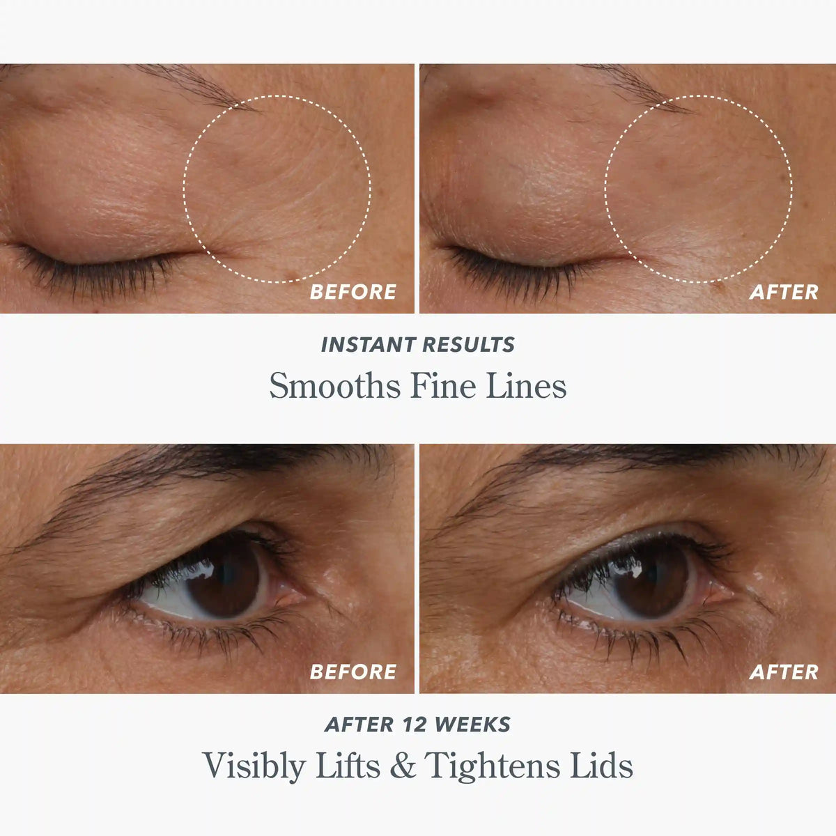 Milk RX Advanced Better Aging Dual Eye Treatments