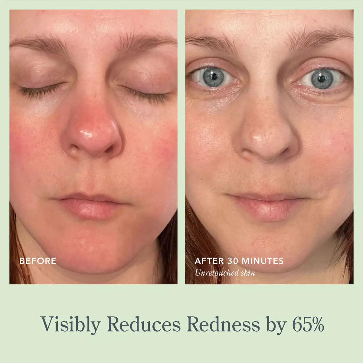 Get Misty With It Hydrate & Soothe