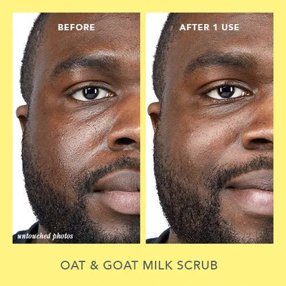 Summer Glow Skincare Set